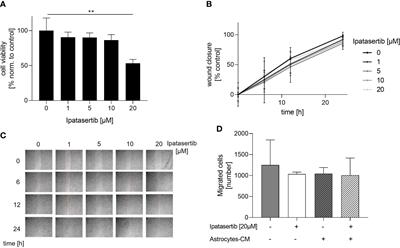 Impact of AKT1 on cell invasion and radiosensitivity in a triple negative breast cancer cell line developing brain metastasis